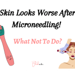 Skin Looks Worse After Microneedling 